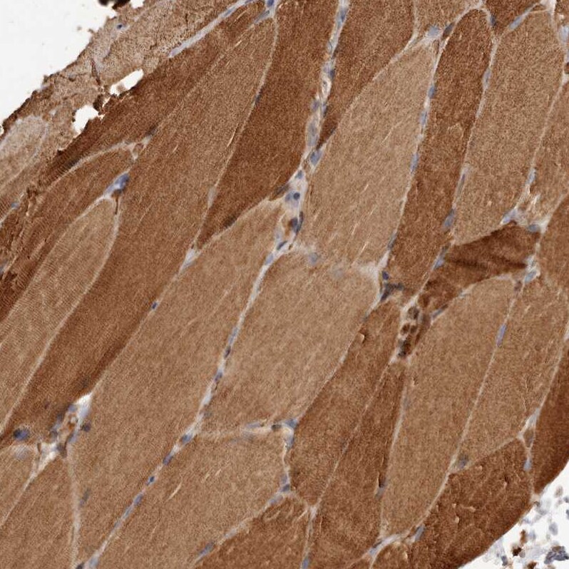 GTP-binding protein 1 Antibody - BSA Free Immunohistochemistry-Paraffin: GTP-binding protein 1 Antibody - BSA Free [NBP1-89746]