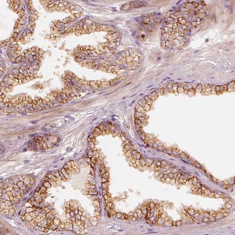 GRASP55 Antibody - BSA Free Immunohistochemistry-Paraffin: GRASP55 Antibody - BSA Free [NBP1-89747]