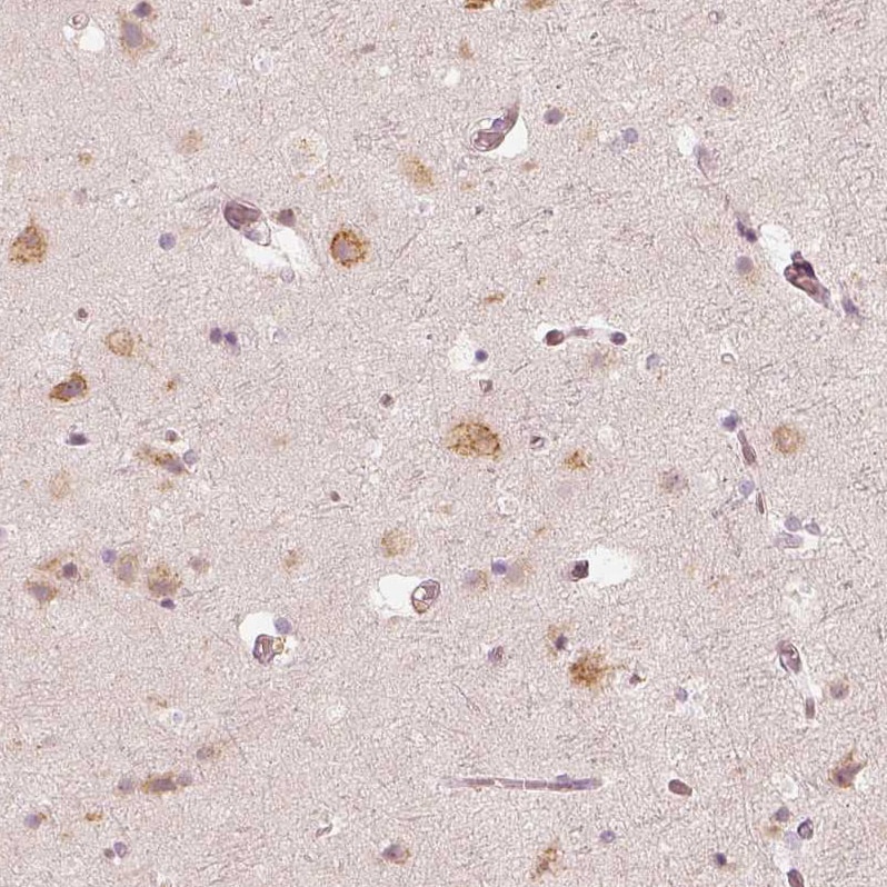 GRASP55 Antibody - BSA Free Immunohistochemistry-Paraffin: GRASP55 Antibody - BSA Free [NBP1-89747]