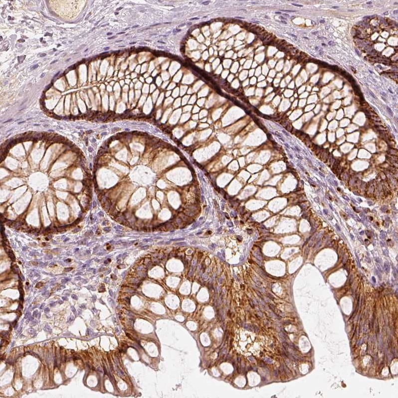 GRASP55 Antibody - BSA Free Immunohistochemistry-Paraffin: GRASP55 Antibody - BSA Free [NBP1-89747]