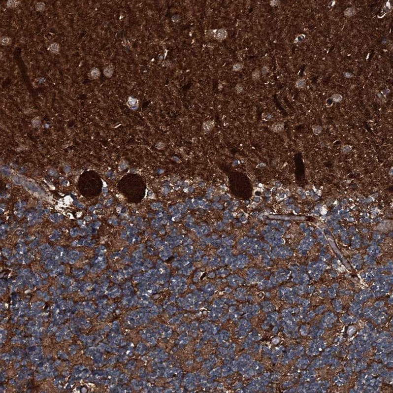 GNIP Antibody - BSA Free Immunohistochemistry-Paraffin: GNIP Antibody [NBP1-89751]