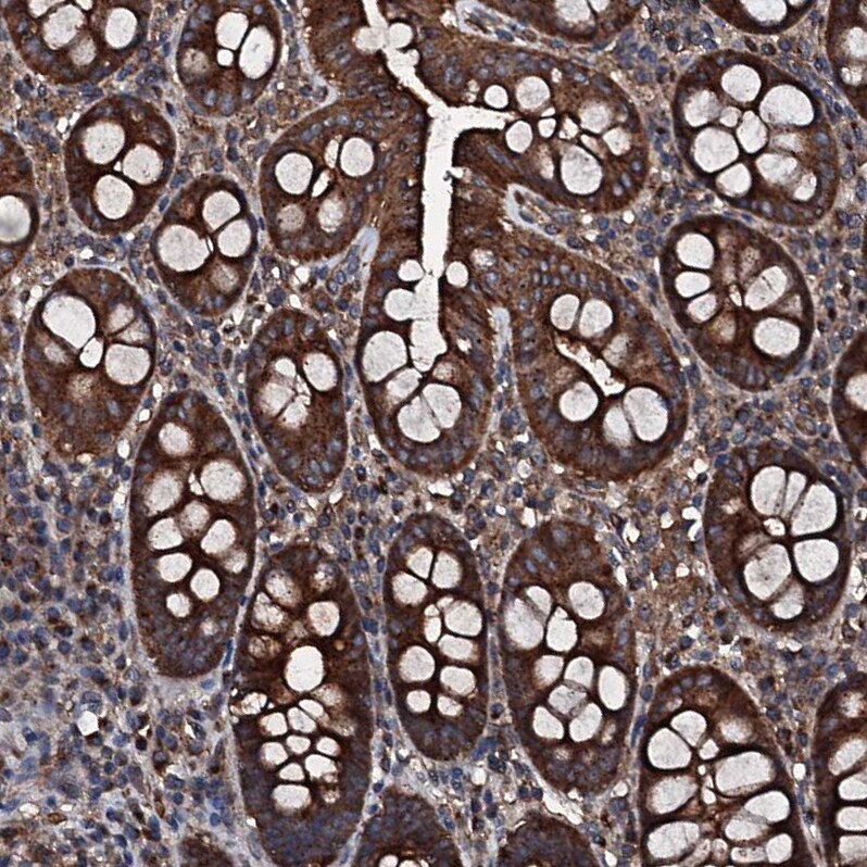 GNIP Antibody - BSA Free Immunohistochemistry-Paraffin: GNIP Antibody [NBP1-89751]