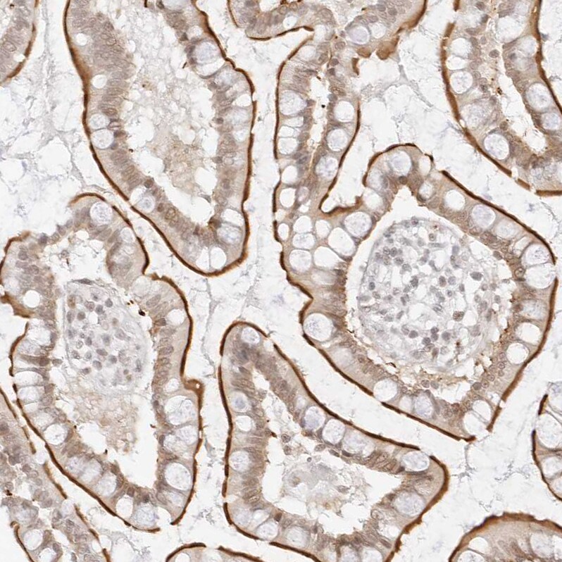 G protein alpha Antibody - BSA Free Immunohistochemistry-Paraffin: G protein alpha Antibody - BSA Free [NBP1-89753]