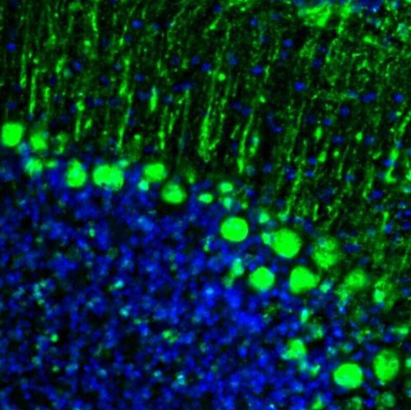 GMF-beta Antibody - BSA Free Immunohistochemistry-Paraffin: GMF-beta Antibody - BSA Free [NBP1-89755]
