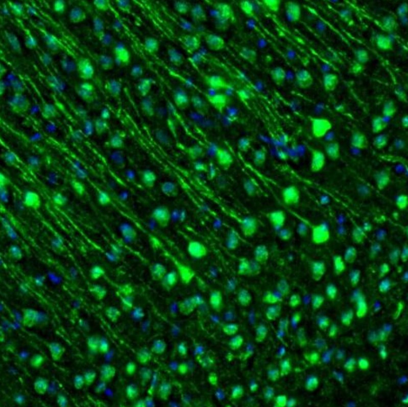 GMF-beta Antibody - BSA Free Immunohistochemistry-Paraffin: GMF-beta Antibody - BSA Free [NBP1-89755]