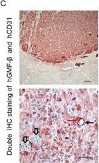 GMF-beta Antibody