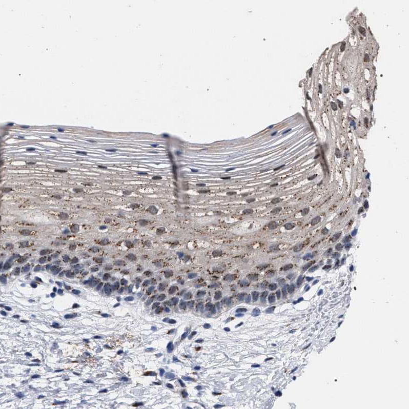 GM130/GOLGA2 Antibody - BSA Free Immunohistochemistry-Paraffin: GM130/GOLGA2 Antibody - BSA Free [NBP1-89756]