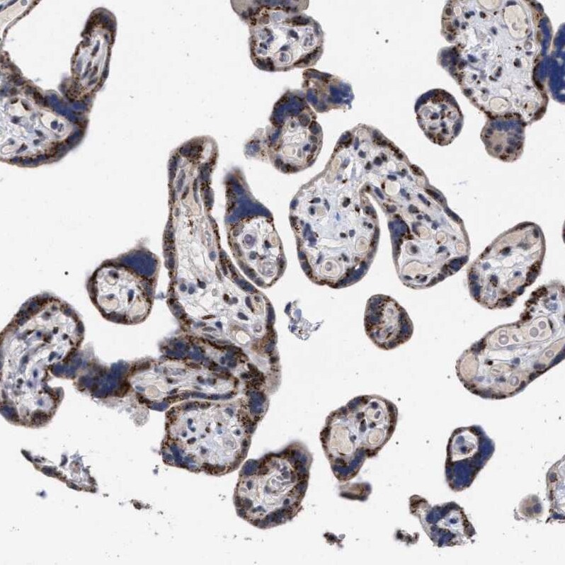 GM130/GOLGA2 Antibody - BSA Free Immunohistochemistry-Paraffin: GM130/GOLGA2 Antibody - BSA Free [NBP1-89756]