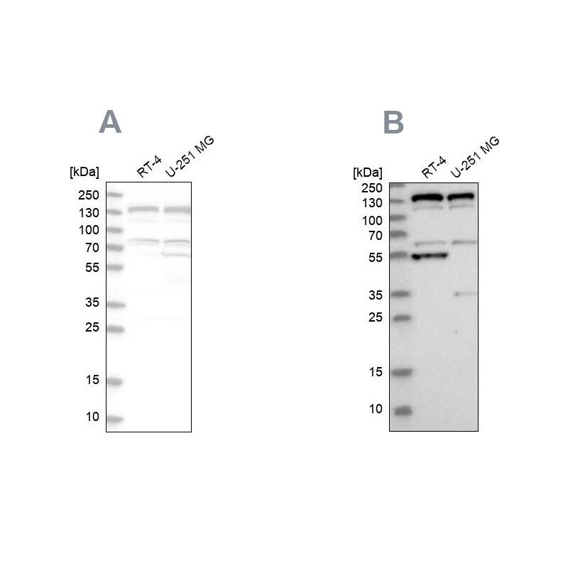 GM130/GOLGA2 Antibody - BSA Free Western Blot: GM130/GOLGA2 Antibody - BSA Free [NBP1-89758]