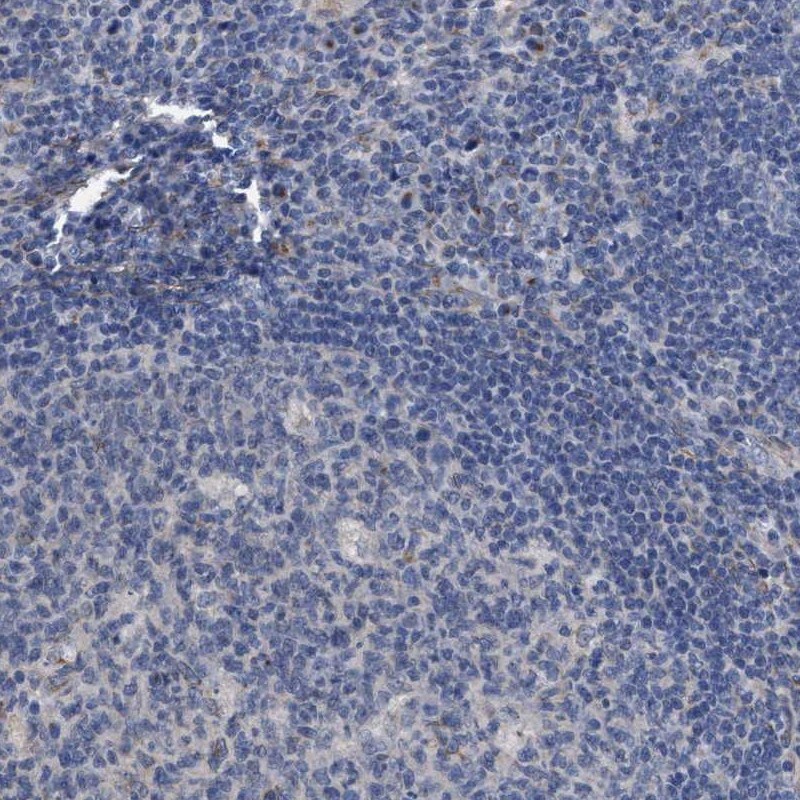 GM130/GOLGA2 Antibody - BSA Free Immunohistochemistry-Paraffin: GM130/GOLGA2 Antibody - BSA Free [NBP1-89758]