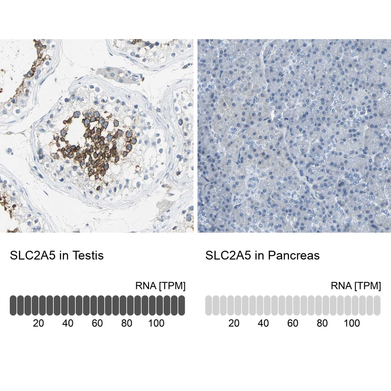 Glut5 Antibody - BSA Free Immunohistochemistry-Paraffin: Glut5 Antibody - BSA Free [NBP1-89761]