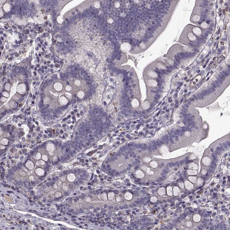 Glut3 Antibody - BSA Free Immunohistochemistry-Paraffin: Glut3 Antibody - BSA Free [NBP1-89762]