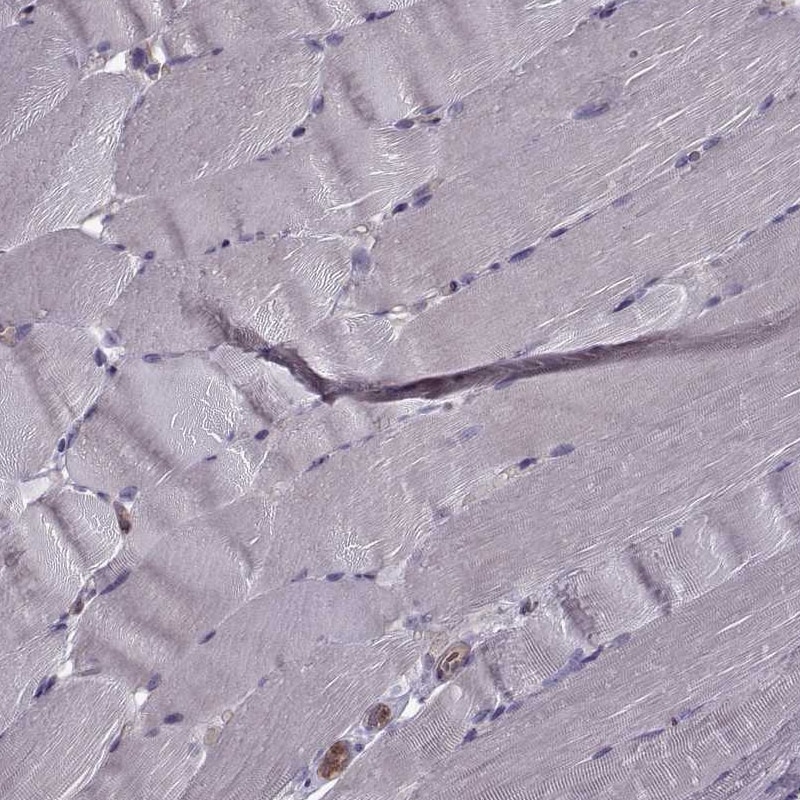 Glut3 Antibody - BSA Free Immunohistochemistry-Paraffin: Glut3 Antibody - BSA Free [NBP1-89762]