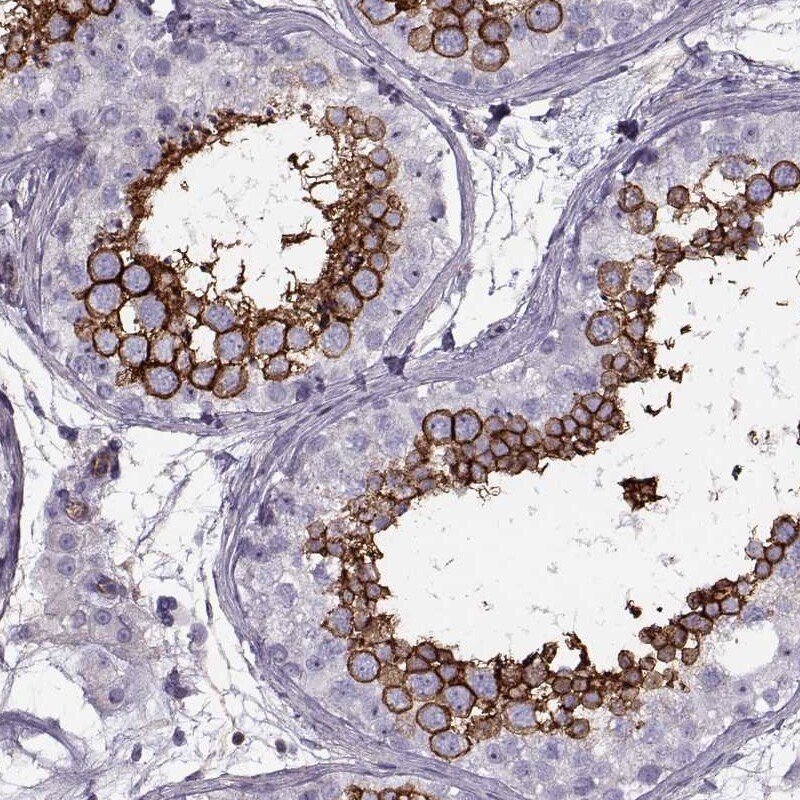 Glut3 Antibody - BSA Free Immunohistochemistry-Paraffin: Glut3 Antibody - BSA Free [NBP1-89762]