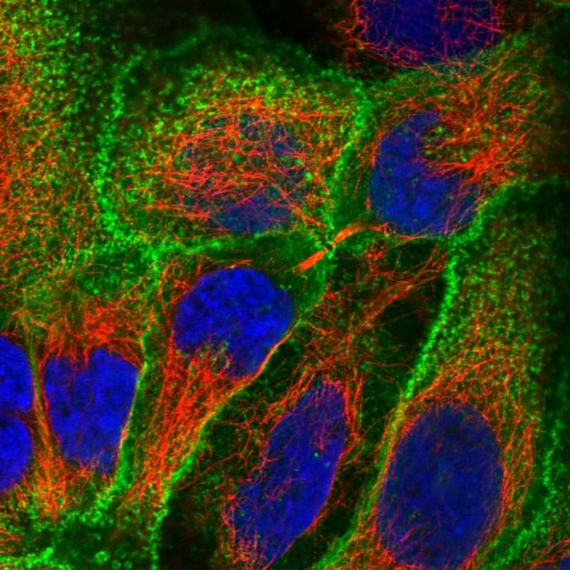Glut3 Antibody - BSA Free Immunocytochemistry/ Immunofluorescence: Glut3 Antibody - BSA Free [NBP1-89762]