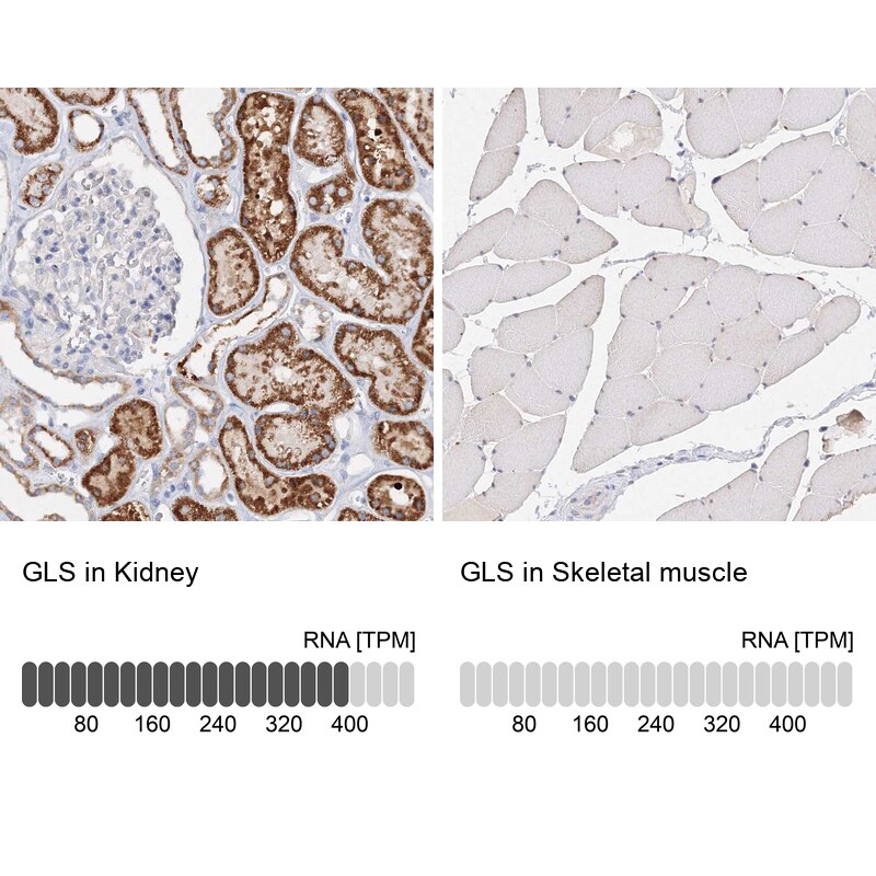 Glutaminase Antibody - BSA Free Immunohistochemistry-Paraffin: Glutaminase Antibody [NBP1-89766]