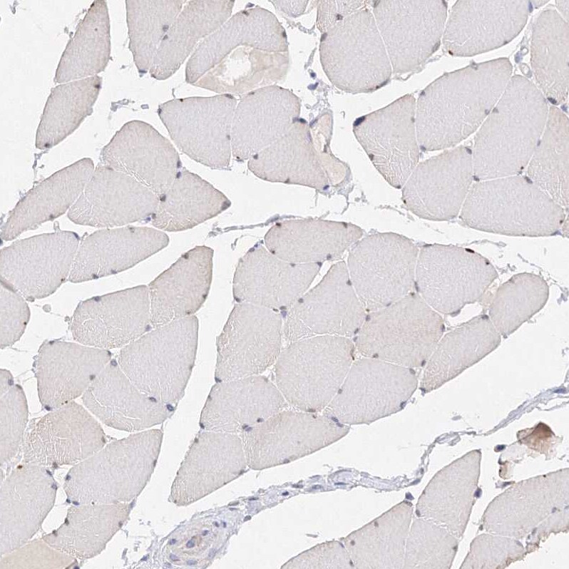 Glutaminase Antibody - BSA Free Immunohistochemistry-Paraffin: Glutaminase Antibody [NBP1-89766]