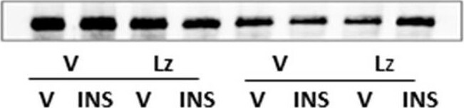 Glutaminase Antibody