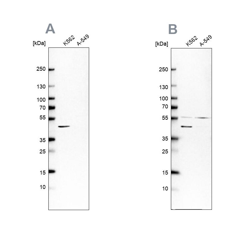 Glutamine Synthetase Antibody - BSA Free Western Blot: Glutamine Synthetase Antibody - BSA Free [NBP1-89768]