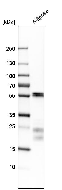 Myocilin Antibody - BSA Free Western Blot: Myocilin Antibody - BSA Free [NBP1-89769]