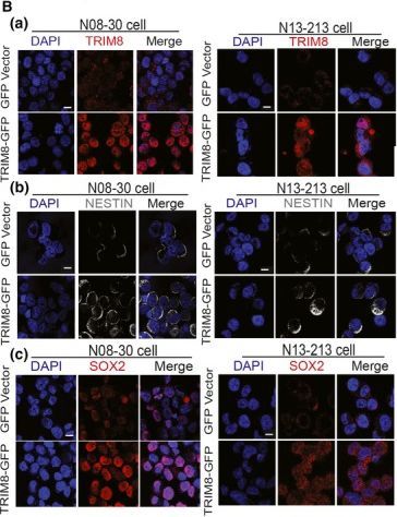 TRIM8 Antibody