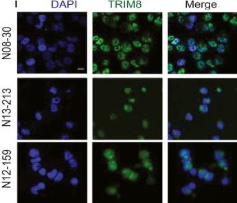 TRIM8 Antibody