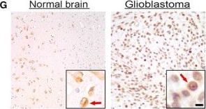 TRIM8 Antibody - BSA Free