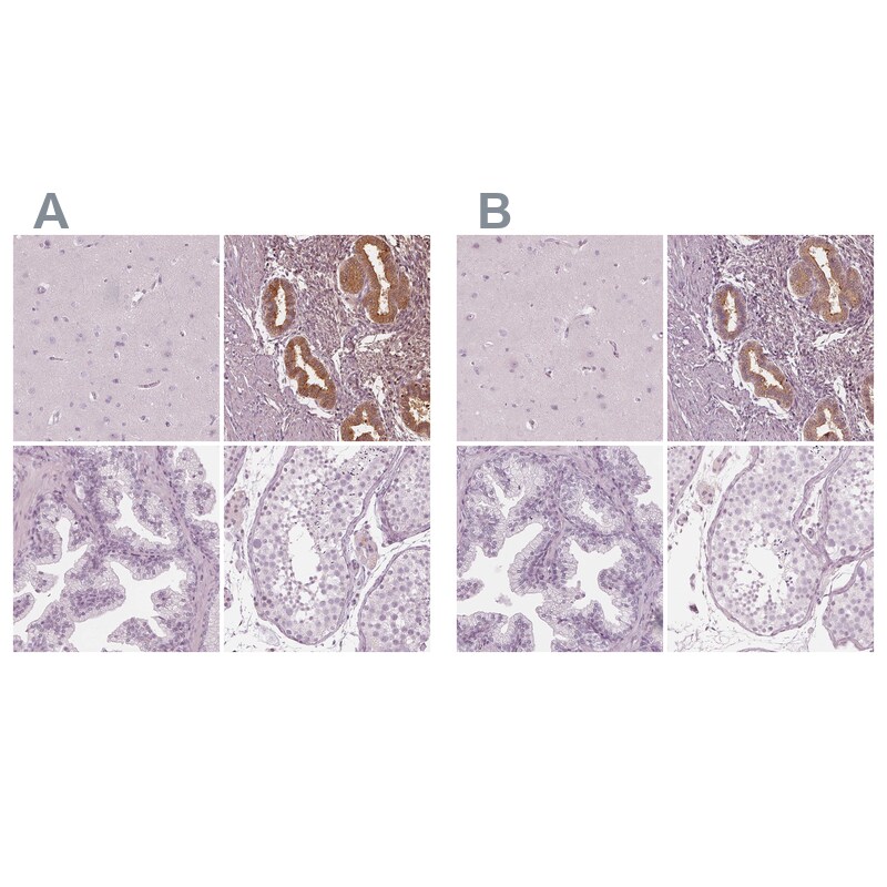 PP14/Glycodelin Antibody - BSA Free Immunohistochemistry-Paraffin: PP14/Glycodelin Antibody [NBP1-89781]