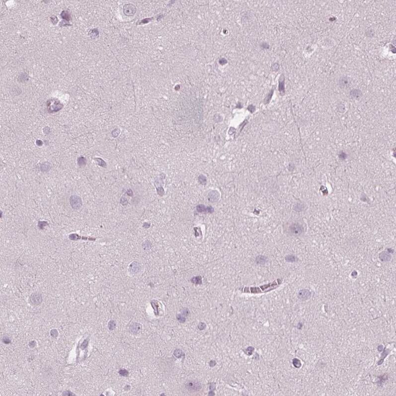 PP14/Glycodelin Antibody - BSA Free Immunohistochemistry-Paraffin: PP14/Glycodelin Antibody - BSA Free [NBP1-89781]