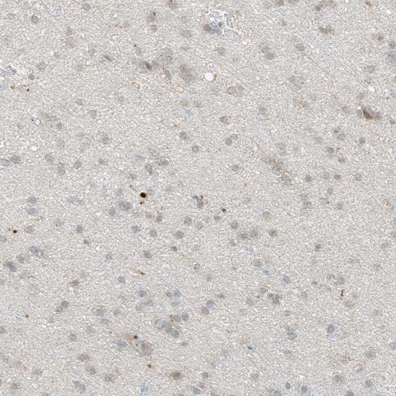 Grancalcin Antibody - BSA Free Immunohistochemistry-Paraffin: Grancalcin Antibody - BSA Free [NBP1-89785]