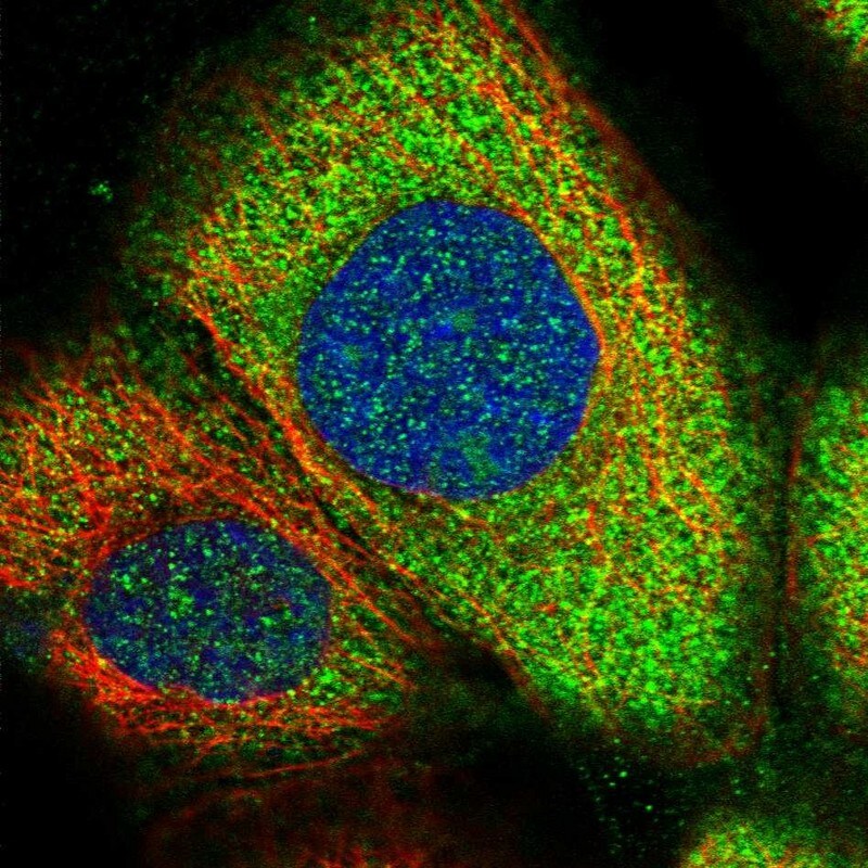 Grancalcin Antibody - BSA Free Immunocytochemistry/ Immunofluorescence: Grancalcin Antibody [NBP1-89786]