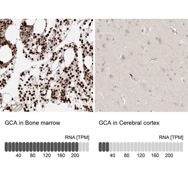 Grancalcin Antibody - BSA Free Immunohistochemistry-Paraffin: Grancalcin Antibody - BSA Free [NBP1-89786]