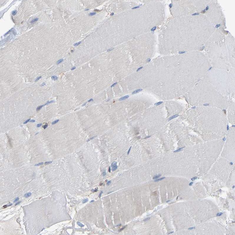 Myotrophin Antibody - BSA Free Immunohistochemistry-Paraffin: Myotrophin Antibody [NBP1-89787]