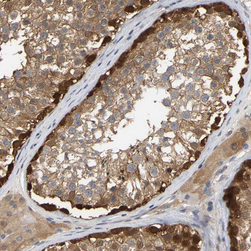Myotrophin Antibody - BSA Free Immunohistochemistry-Paraffin: Myotrophin Antibody [NBP1-89787]