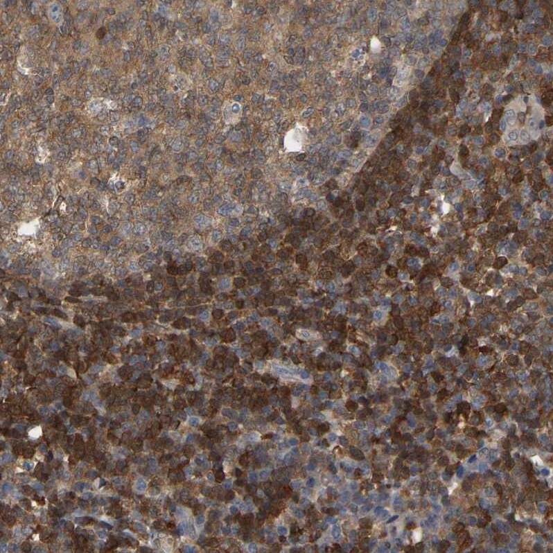 Myotrophin Antibody - BSA Free Immunohistochemistry-Paraffin: Myotrophin Antibody [NBP1-89787]
