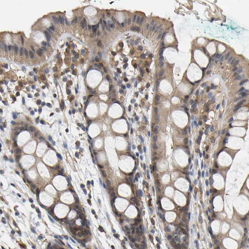 Myotrophin Antibody - BSA Free Immunohistochemistry-Paraffin: Myotrophin Antibody [NBP1-89787]