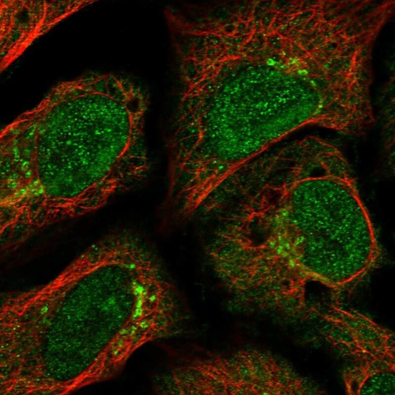 GCC185 Antibody - BSA Free Immunocytochemistry/ Immunofluorescence: GCC185 Antibody [NBP1-89788]