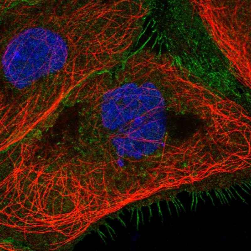 HABP1/C1QBP/GC1q R Antibody - BSA Free Immunocytochemistry/ Immunofluorescence: HABP1/C1QBP/GC1q R Antibody - BSA Free [NBP1-89790]