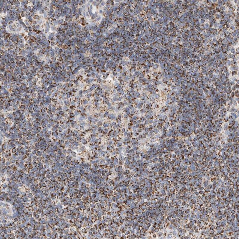 HABP1/C1QBP/GC1q R Antibody - BSA Free Immunohistochemistry-Paraffin: HABP1/C1QBP/GC1q R Antibody - BSA Free [NBP1-89790]