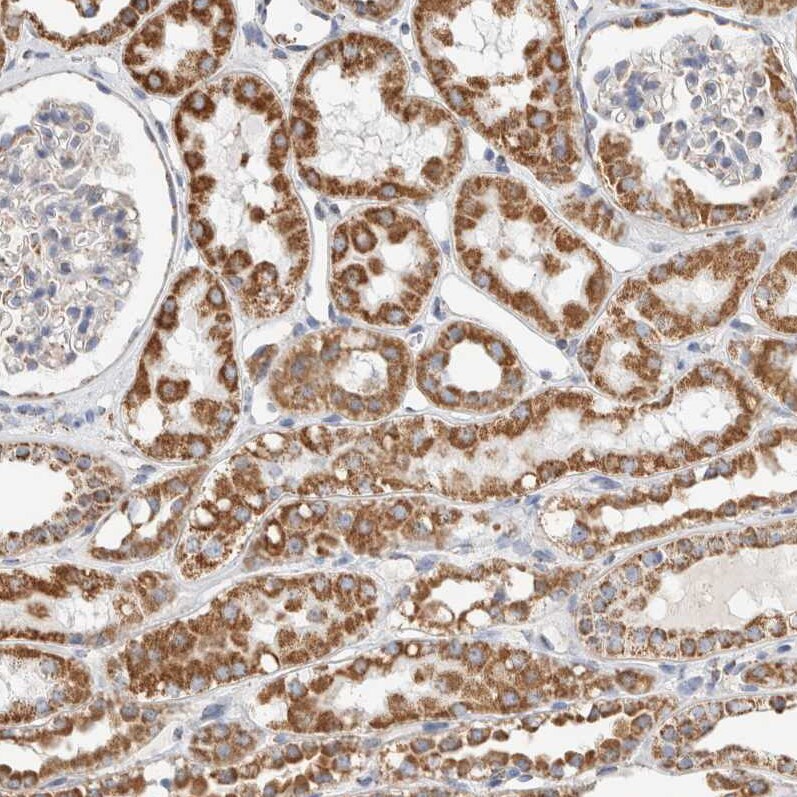 HABP1/C1QBP/GC1q R Antibody - BSA Free Immunohistochemistry-Paraffin: HABP1/C1QBP/GC1q R Antibody - BSA Free [NBP1-89790]