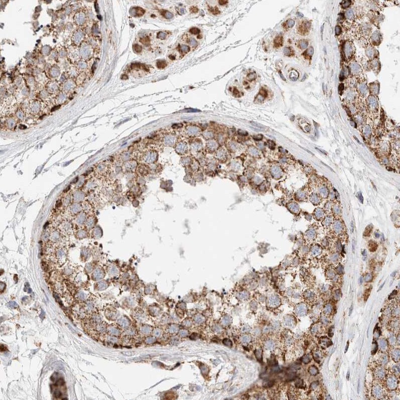 HABP1/C1QBP/GC1q R Antibody - BSA Free Immunohistochemistry-Paraffin: HABP1/C1QBP/GC1q R Antibody - BSA Free [NBP1-89790]