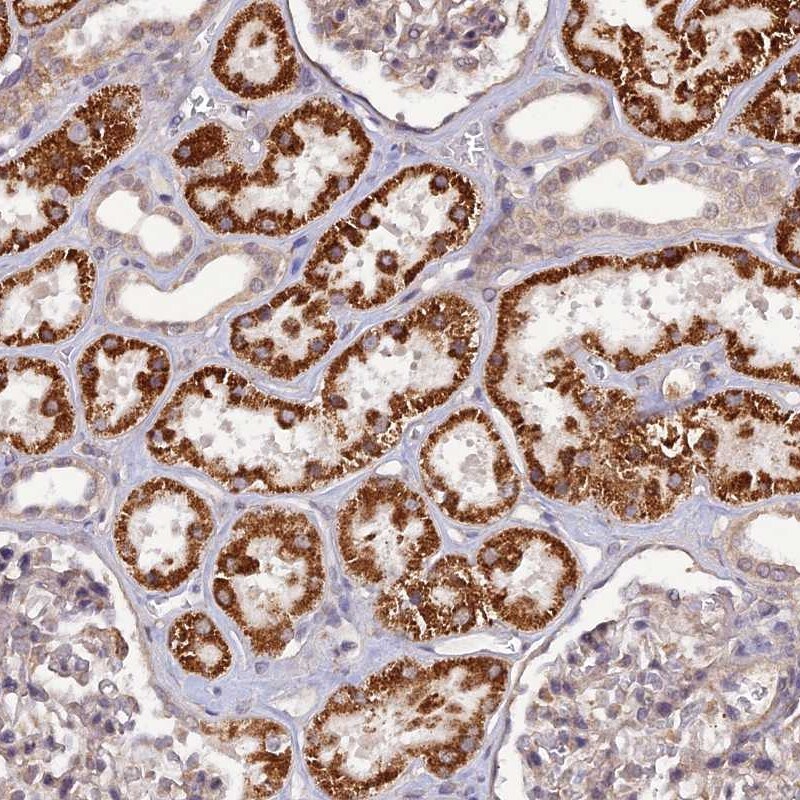 PA1 Antibody - BSA Free Immunohistochemistry: PA1 Antibody - BSA Free [NBP1-89793]