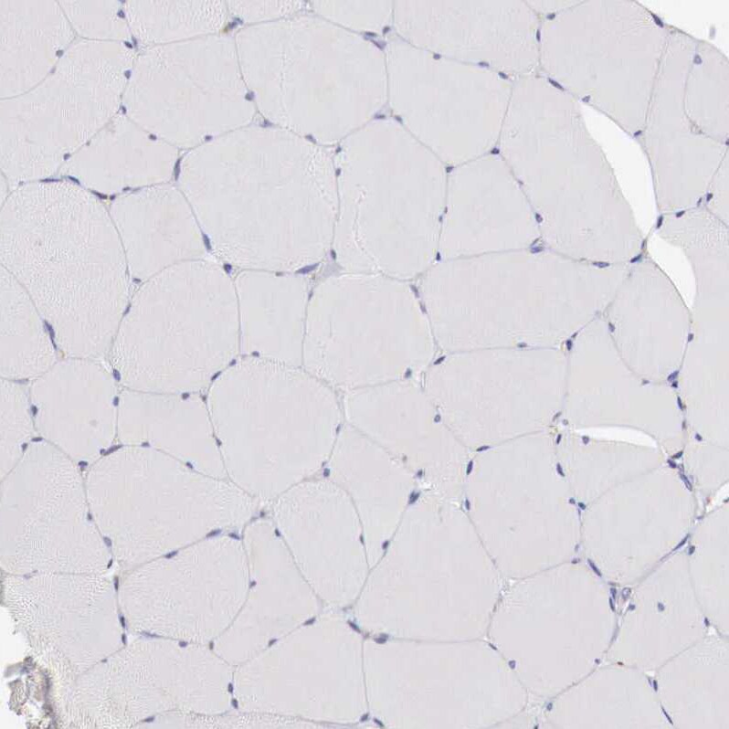 alpha-Galactosidase A/GLA Antibody - BSA Free Immunohistochemistry-Paraffin: alpha-Galactosidase A/GLA Antibody - BSA Free [NBP1-89796]