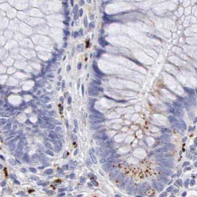 alpha-Galactosidase A/GLA Antibody - BSA Free Immunohistochemistry-Paraffin: alpha-Galactosidase A/GLA Antibody - BSA Free [NBP1-89796]