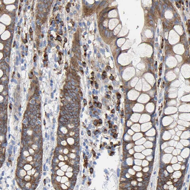 GADD34 Antibody - BSA Free Immunohistochemistry-Paraffin: GADD34 Antibody - BSA Free [NBP1-89800]