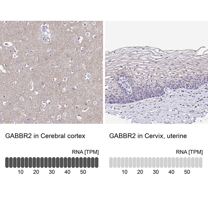 GABA-B R2 Antibody - BSA Free Immunohistochemistry-Paraffin: GABA-B R2 Antibody - BSA Free [NBP1-89803]