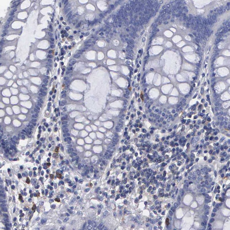 Glucose 6 Phosphate Dehydrogenase Antibody - BSA Free Immunohistochemistry-Paraffin: Glucose 6 Phosphate Dehydrogenase Antibody - BSA Free [NBP1-89804]