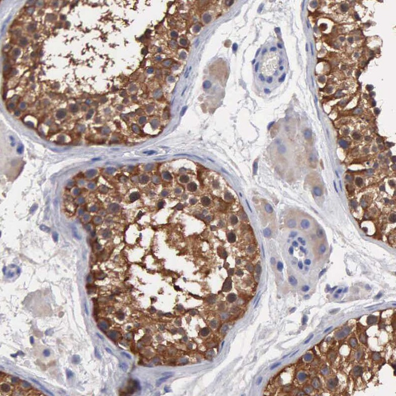 Glucose 6 Phosphate Dehydrogenase Antibody - BSA Free Immunohistochemistry-Paraffin: Glucose 6 Phosphate Dehydrogenase Antibody - BSA Free [NBP1-89804]