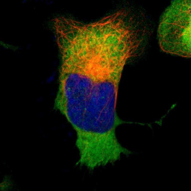 Glucose 6 Phosphate Dehydrogenase Antibody - BSA Free Immunocytochemistry/ Immunofluorescence: Glucose 6 Phosphate Dehydrogenase Antibody - BSA Free [NBP1-89805]