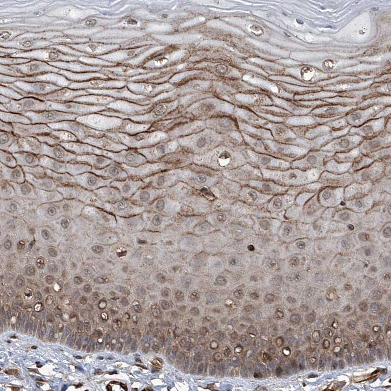 G2A/GPR132 Antibody - BSA Free Immunohistochemistry-Paraffin: G2A/GPR132 Antibody - BSA Free [NBP1-89807]